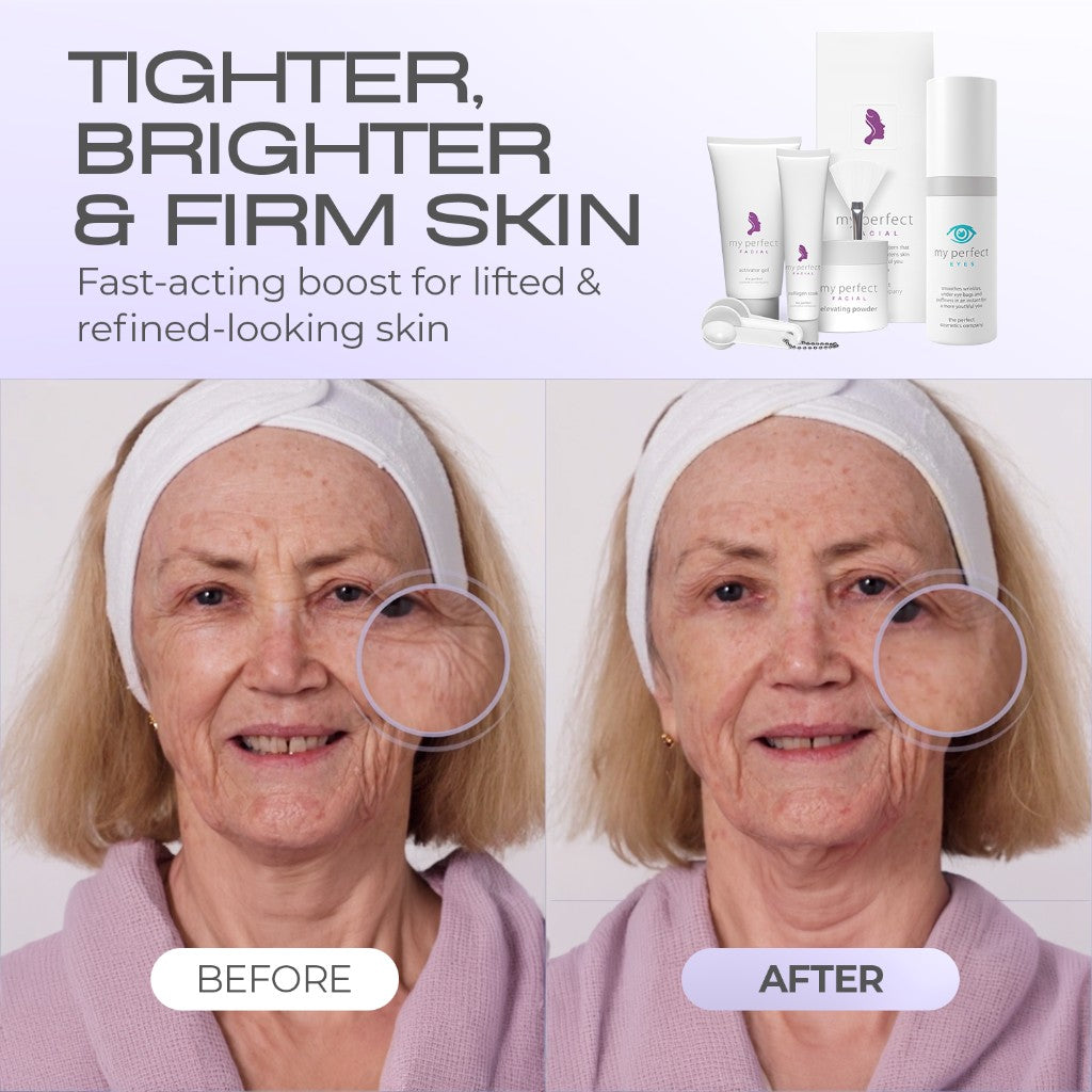 Tighter, brighter and firm skin. Before and after results.